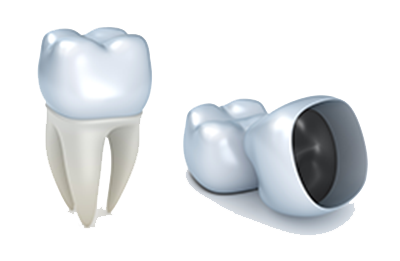 Dental Crowns