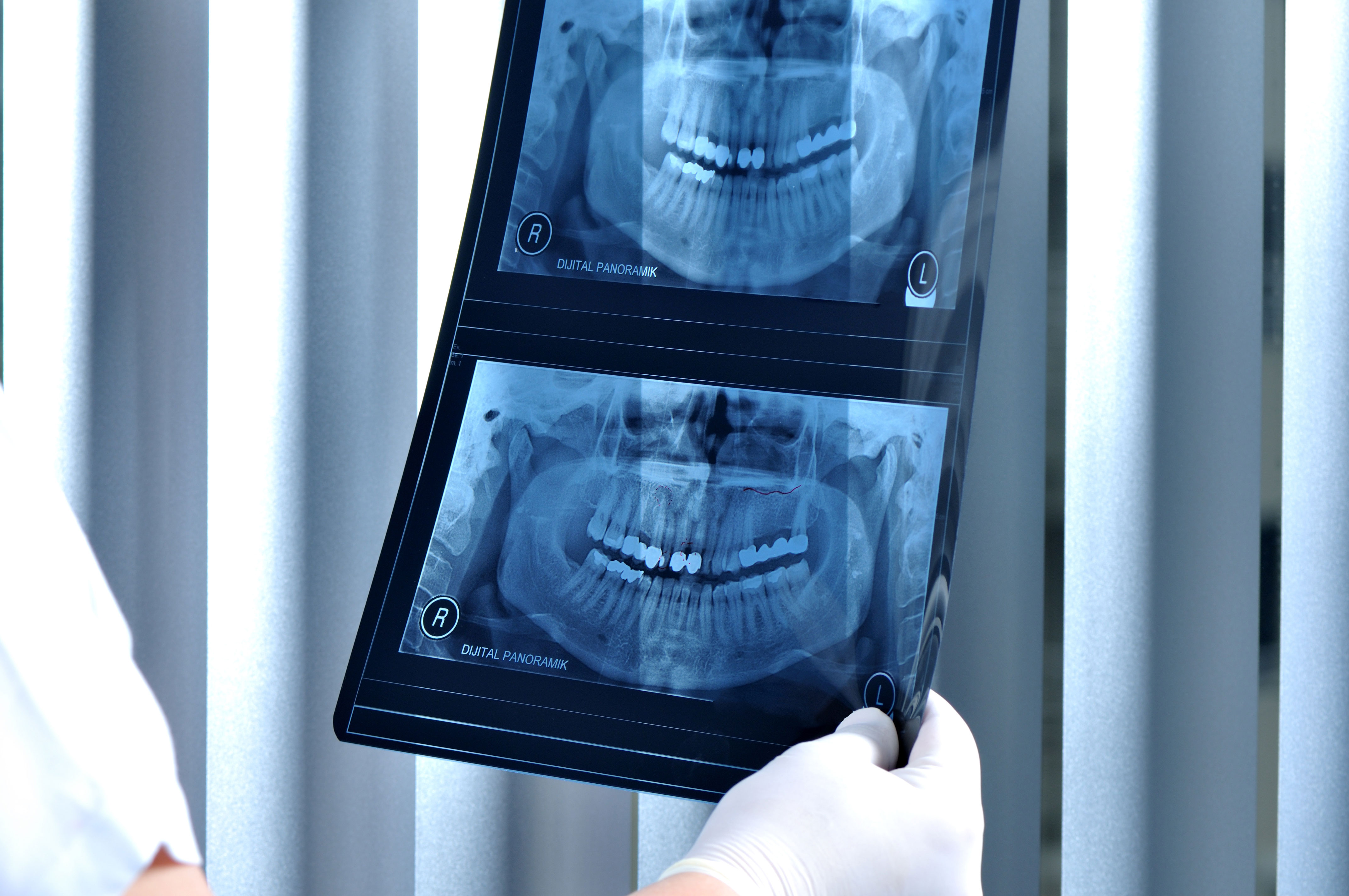 Dental X-Ray